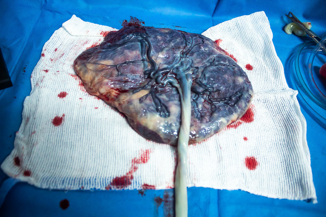 gravidez-amamentaçãoparto-pósparto-domingoslourenço-gestante - ensaio de studiofotografia de parto-nascimento-rn-alieitamento de gestante - parto cesária- parto humanizado- parto normal