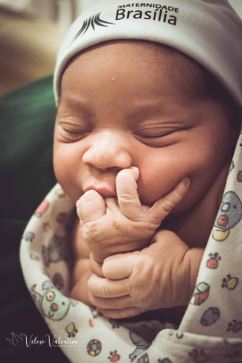 Vídeo de parto com cesárea spinning babies analgesia maternidade Brasília equipe Nascentia Obstetra Mariana Dietz Priscila Medeiros enfermeira obstétrica Doula Adele Valarini acompanhamento pré hospitalar bebê chupando os dedos