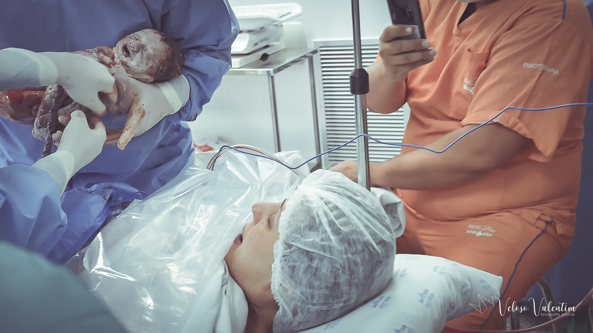 fotografia de parto Vídeo de parto com cesárea spinning babies analgesia Santa Helena equipe Lumiere IBGO Obstetra Luis Otavio Pereira Manes enfermeira obstétrica Natália Schettini e Ana Virgínia Doula Yohanna Cordeiro acompanhamento pré hospitalar