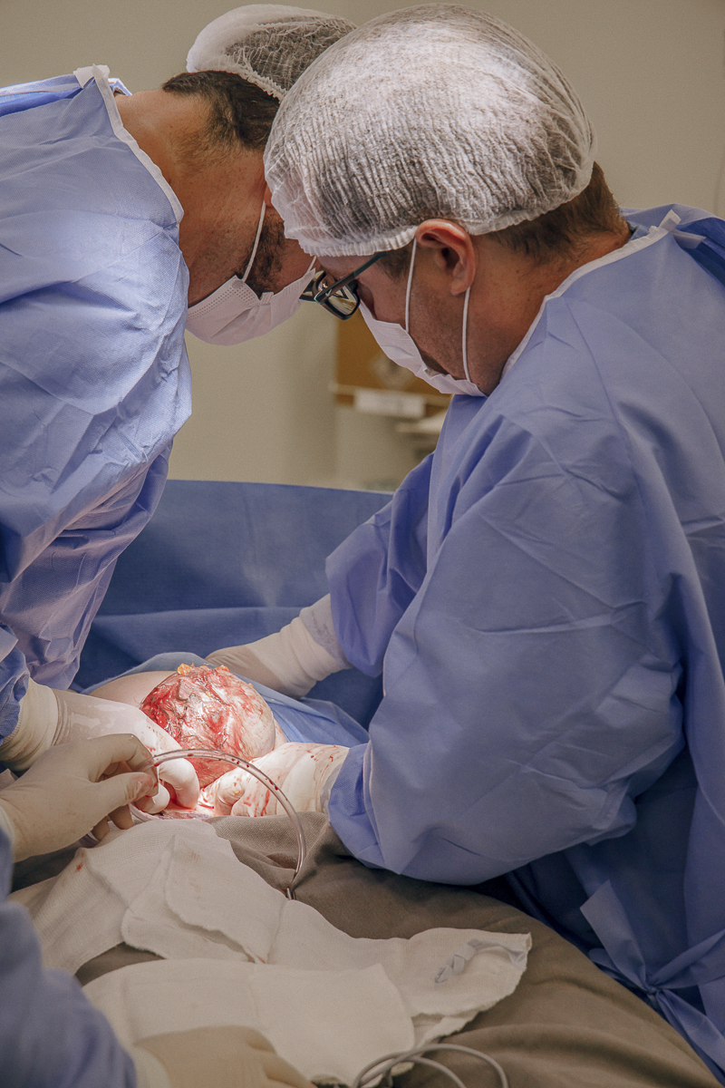 fotografia de parto jau, fotos de parto, bebe nascendo, unimed jau, santa asa jau, unimed bauru, fotografia recem nascido, parto cesarea, fotos de bebe, fotografia em jau e regiao, clinica pailo