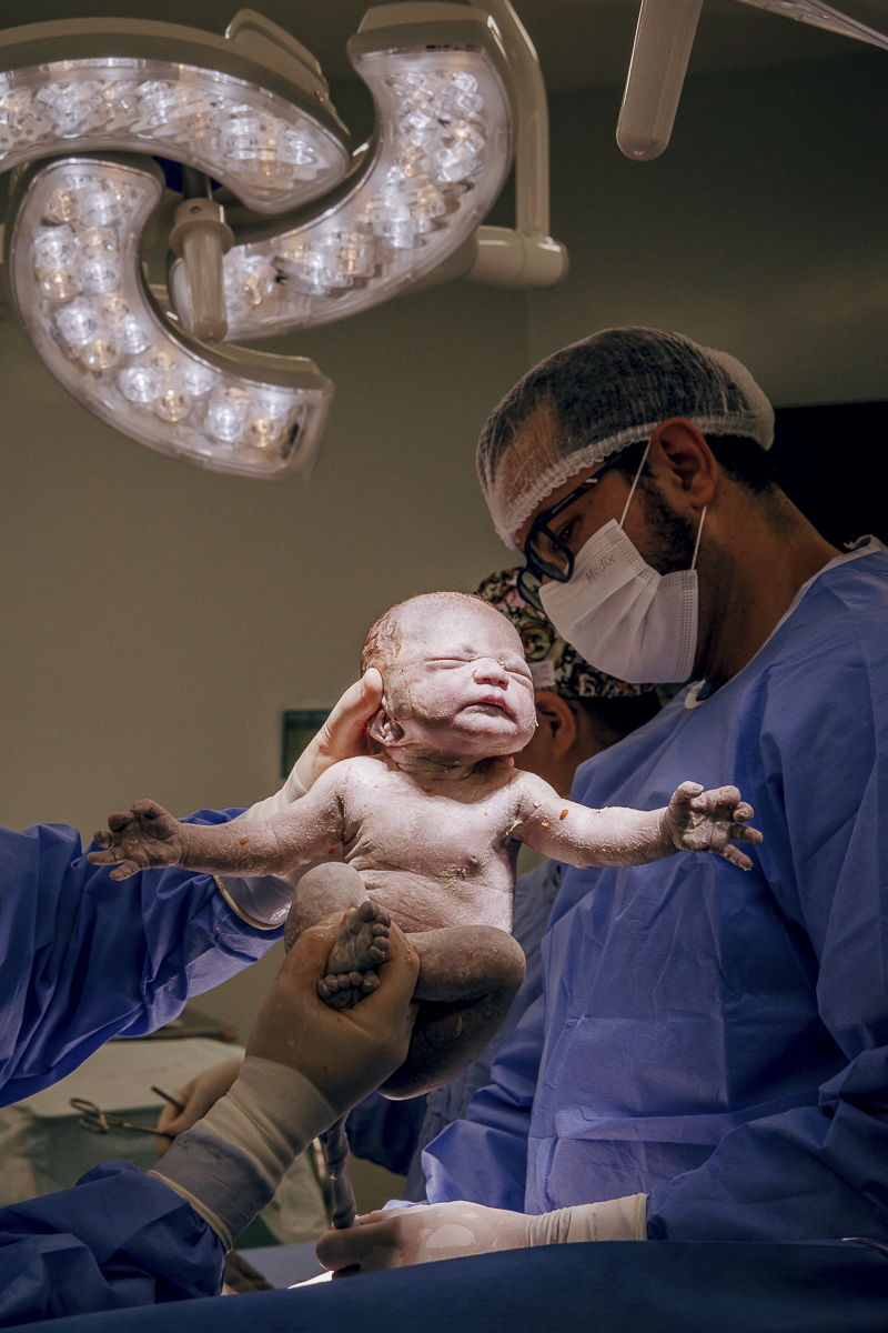 fotografia de parto jau, fotos de parto, bebe nascendo, unimed jau, santa asa jau, unimed bauru, fotografia recem nascido, parto cesarea, fotos de bebe, fotografia em jau e regiao, clinica pailo
