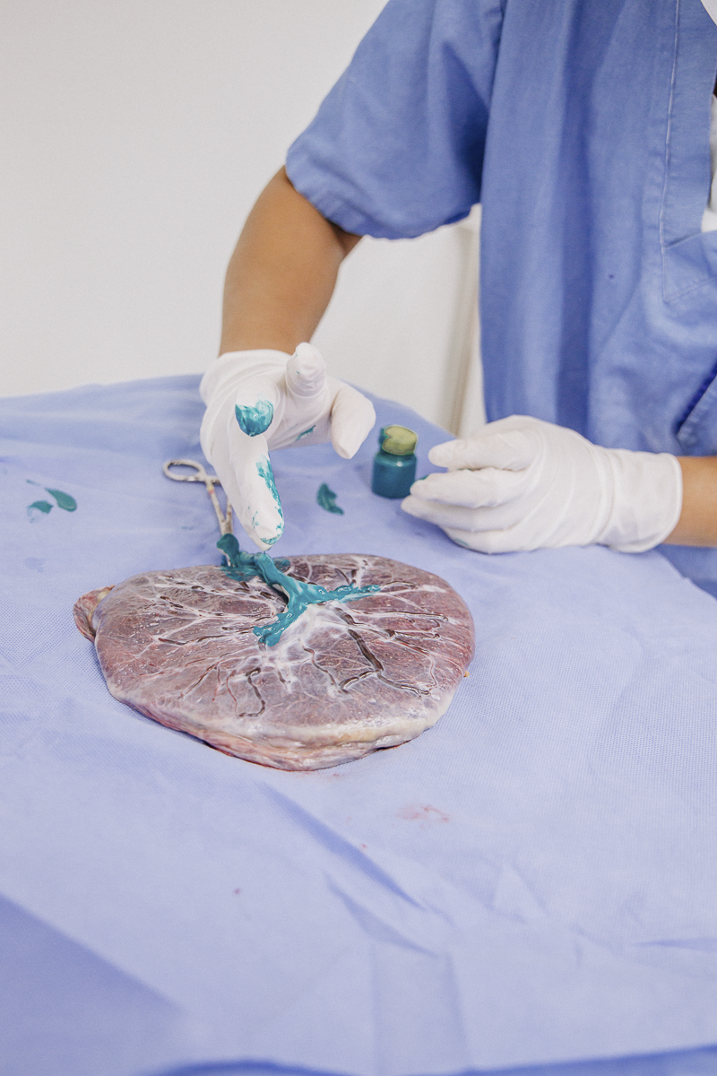 fotografia de parto jau, fotos de parto, bebe nascendo, unimed jau, santa asa jau, unimed bauru, fotografia recem nascido, parto cesarea, fotos de bebe, fotografia em jau e regiao, clinica pailo