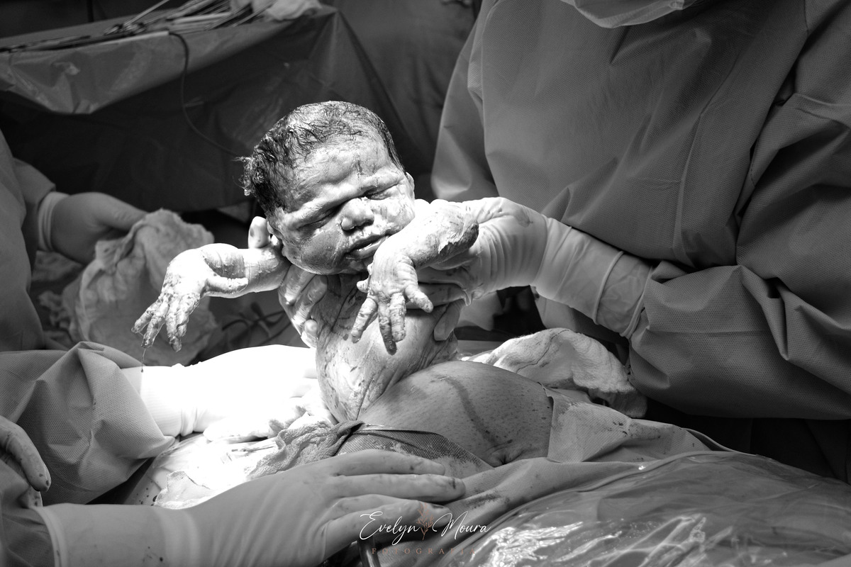 Fotografia de Parto - Newborn - Evelyn Moura Fotografia em Niterói, Rio de Janeiro - ensaio infantil - newborn de recém nascido