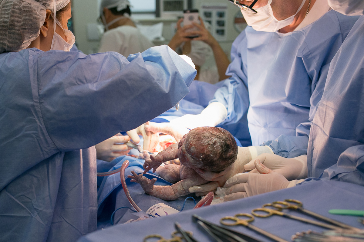 fotografia de parto, nascimento, alegria, amor, família, emoção, parto cesárea, maternidade são josé, rio de janeiro, mãe de menina, pai de menina, registro, vida, fofura, newborn, baby, bebe, recém 
