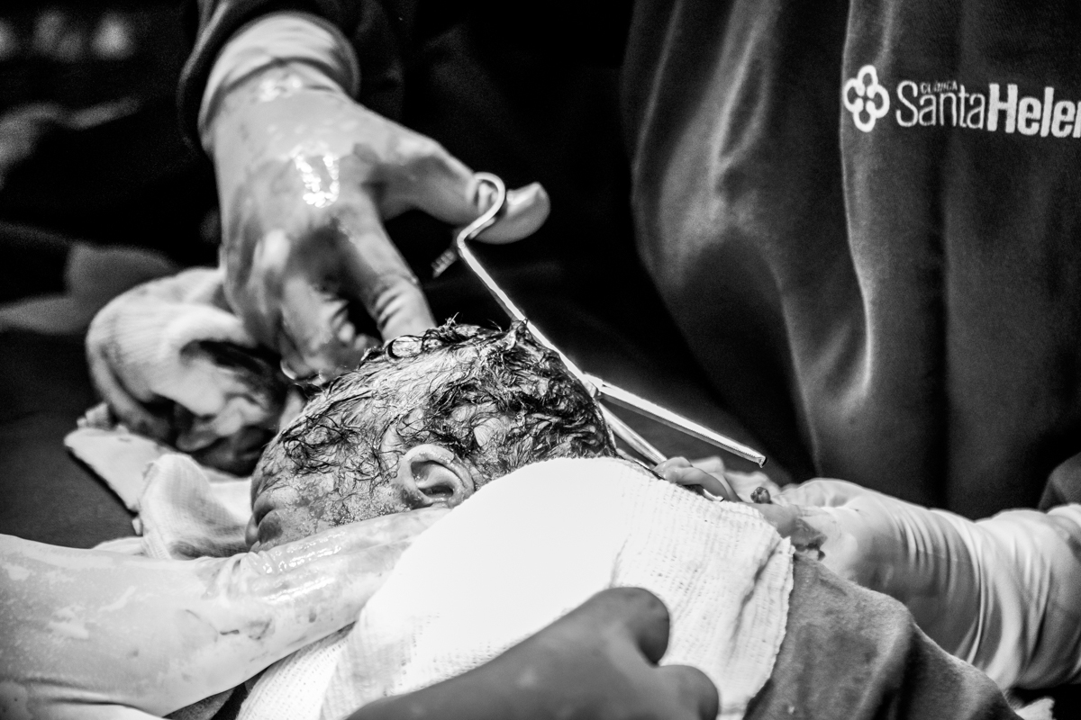 Fotografia e video de parto cesárea na clinica maternidade Santa Helena em florianópolis fotografa palhoça Thayane Peters Fotografia especializada em 