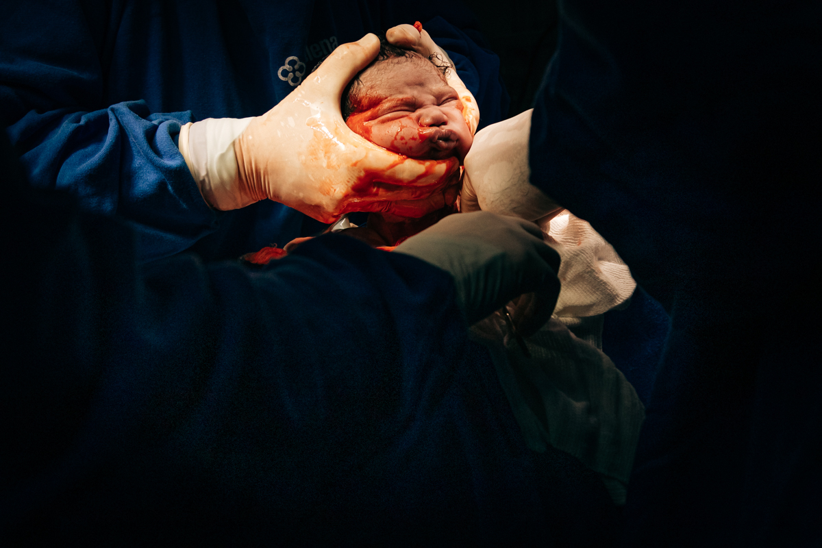 Fotografia e video de parto cesárea na clinica maternidade Santa Helena em florianópolis fotografa palhoça Thayane Peters Fotografia especializada em 