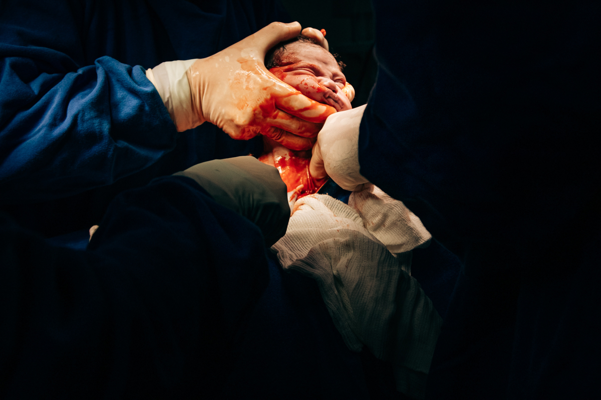 Fotografia e video de parto cesárea na clinica maternidade Santa Helena em florianópolis fotografa palhoça Thayane Peters Fotografia especializada em 