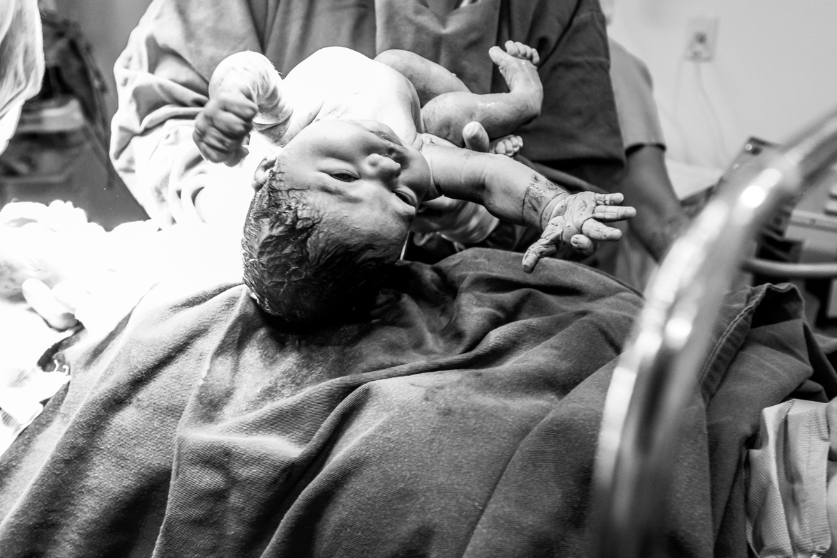 Fotografia e video de parto cesárea na clinica maternidade Santa Helena em florianópolis fotografa palhoça Thayane Peters Fotografia especializada em 