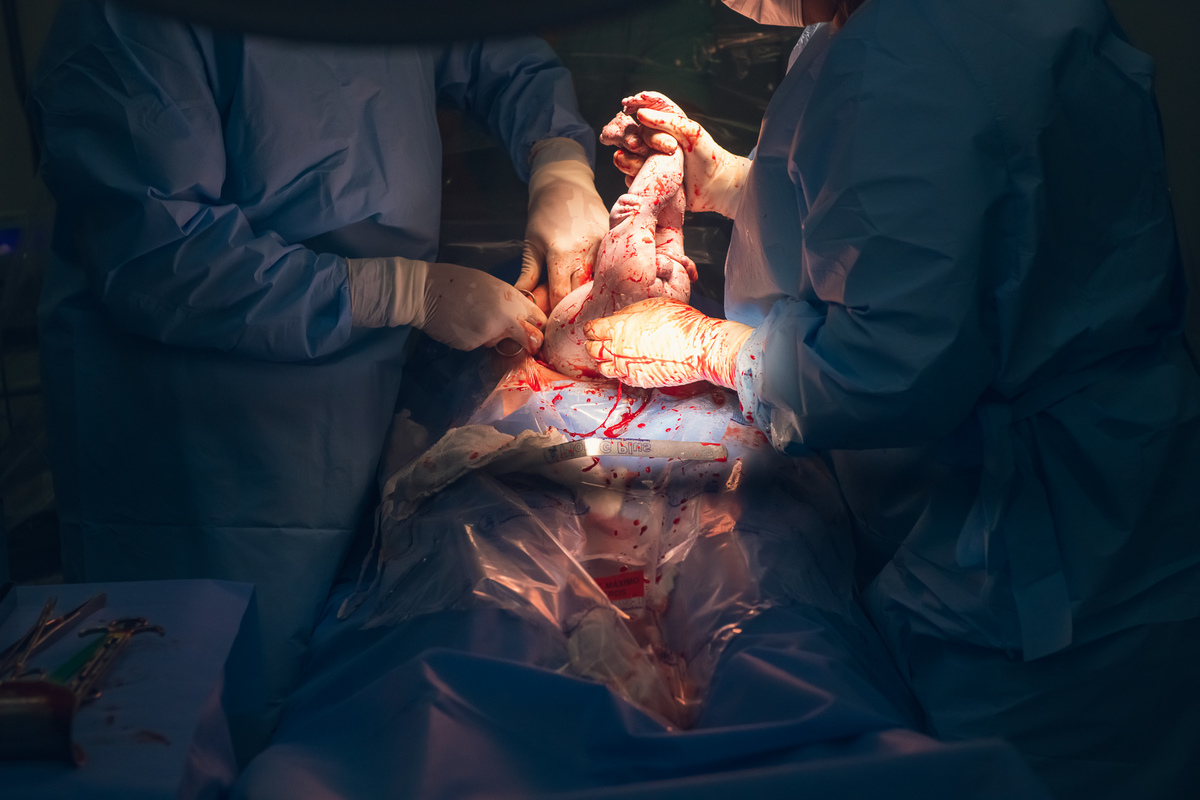 parto, cessaria, mamãe, papai, mãe, pai saúde, família, amor, menina, menino, gravidez, fotografia, barra mansa, volta redonda, rio de janeiro, pediatra, semana, hospital, unimed, pós parto, Ravi