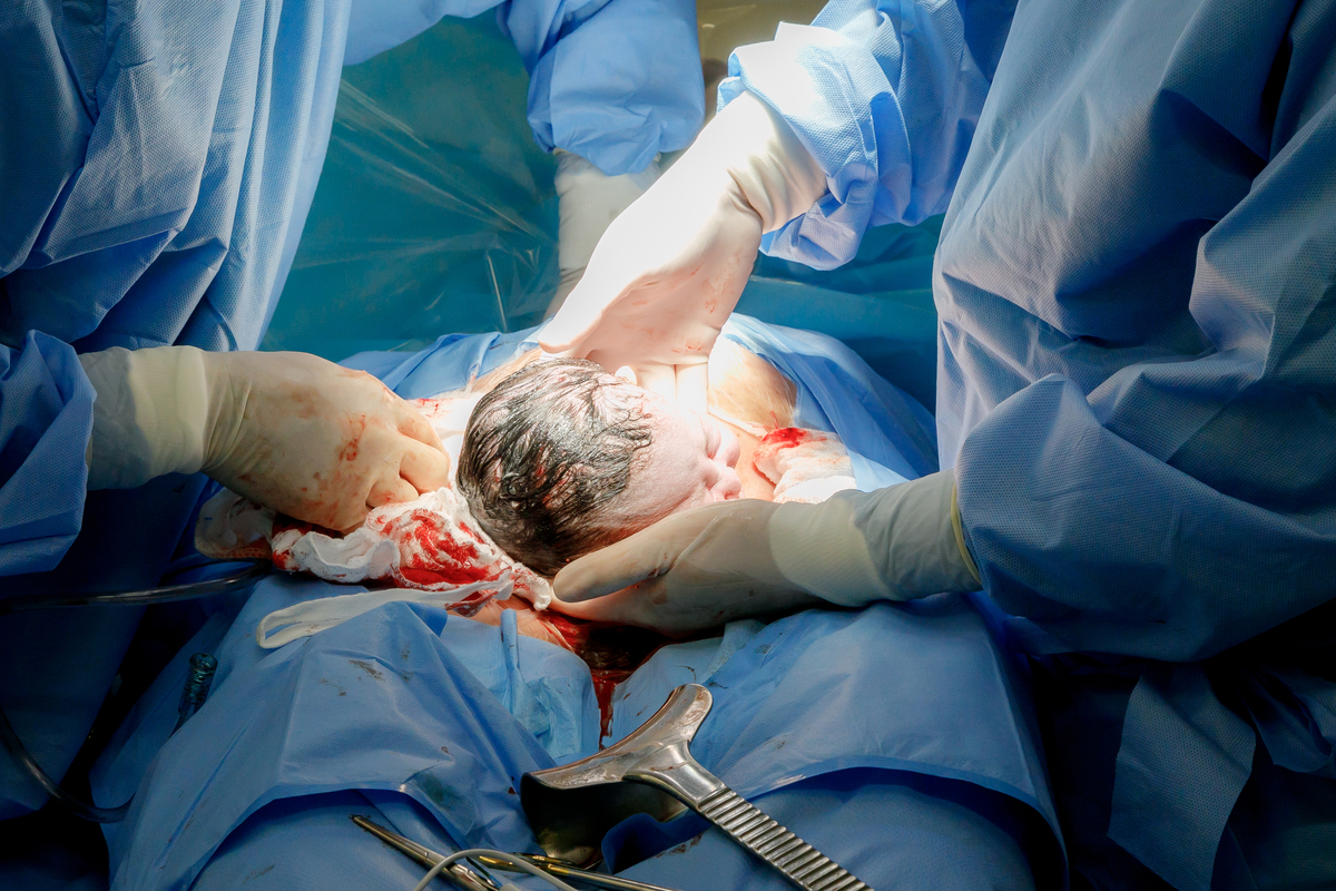 fotografia-de-parto-santo-andre-estudio-thais-castro-sçao-paulo-pro-matre