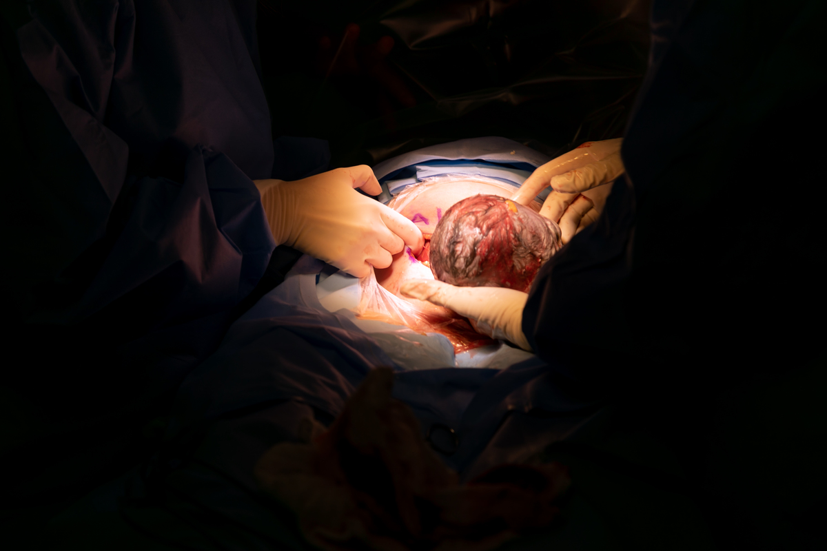 fotografia-de-parto-sao-paulo-estudio-thais-castro-sao-paulo-santa-joana