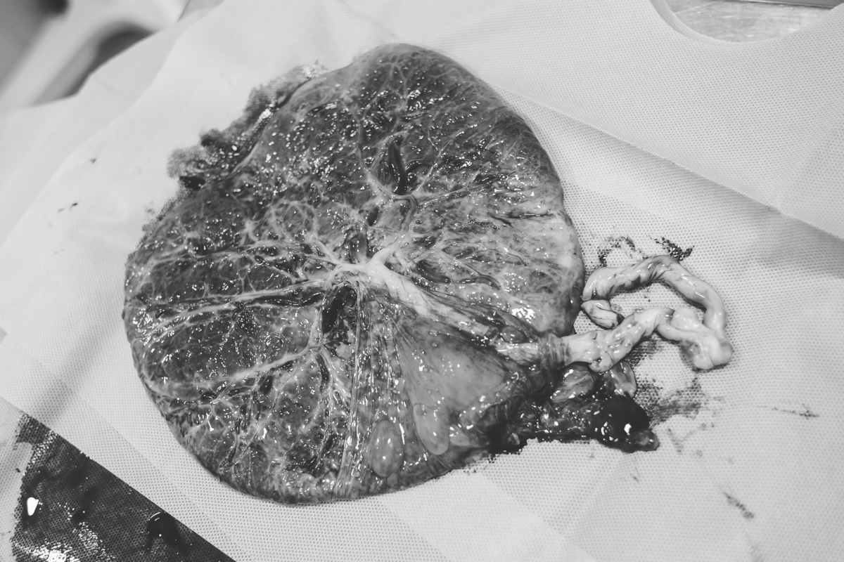 fotografia-de-parto-natural-normal-cesária-hospital-sao-luiz-hospital-brasil-santo-andre-estudio-thais-castro