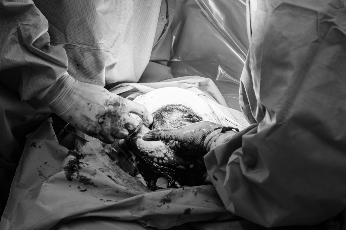 parto-bebe-nascimento-maternidade-santa-joana-cesaria-estudio-santo-andre-thais-castro