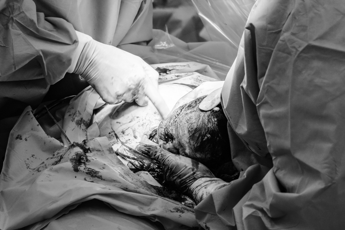 parto-bebe-nascimento-maternidade-santa-joana-cesaria-estudio-santo-andre-thais-castro