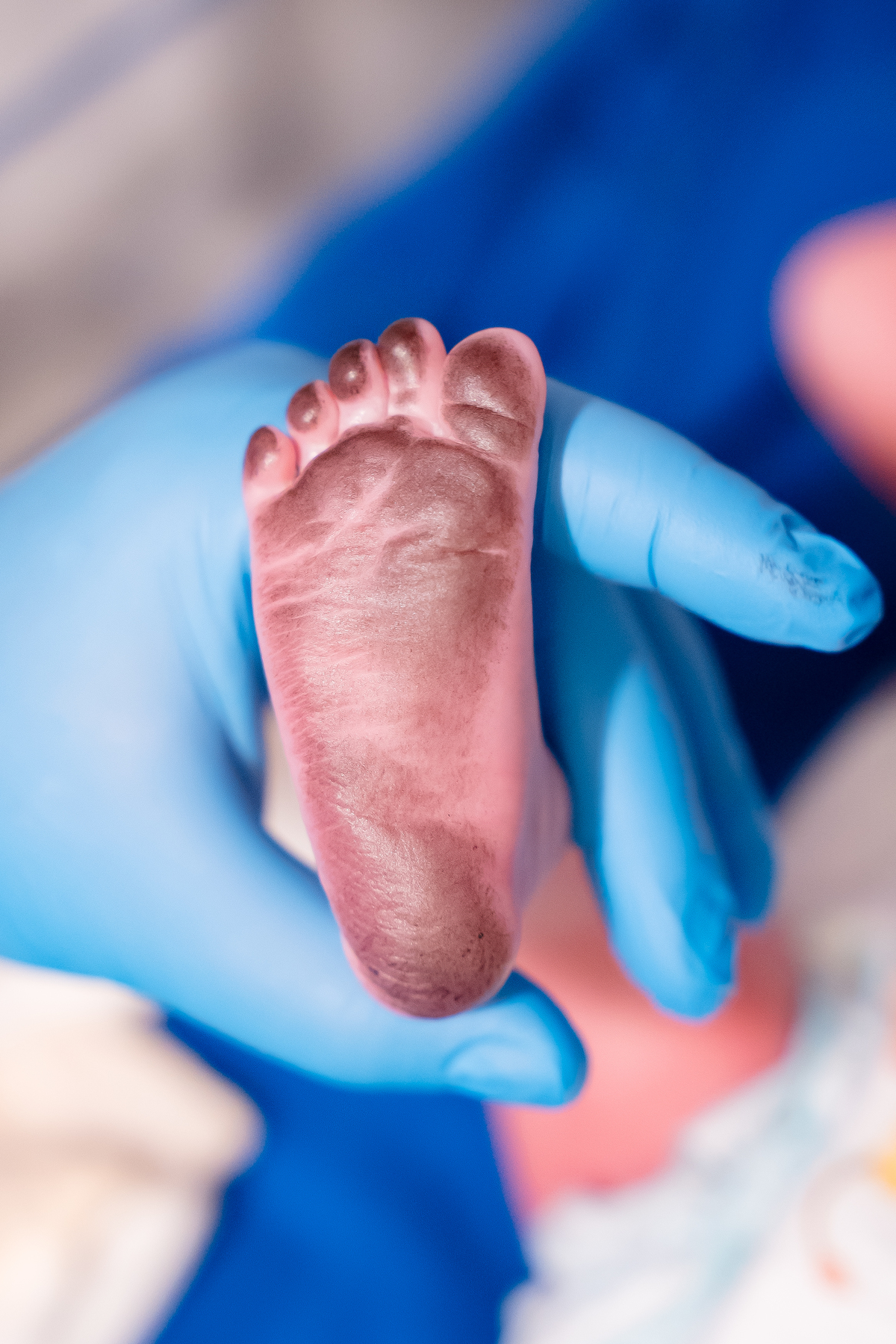 parto-normal-ceariana-star-são-luiz-fotografia-humanizado-são-paulo-estudio-thais-castro