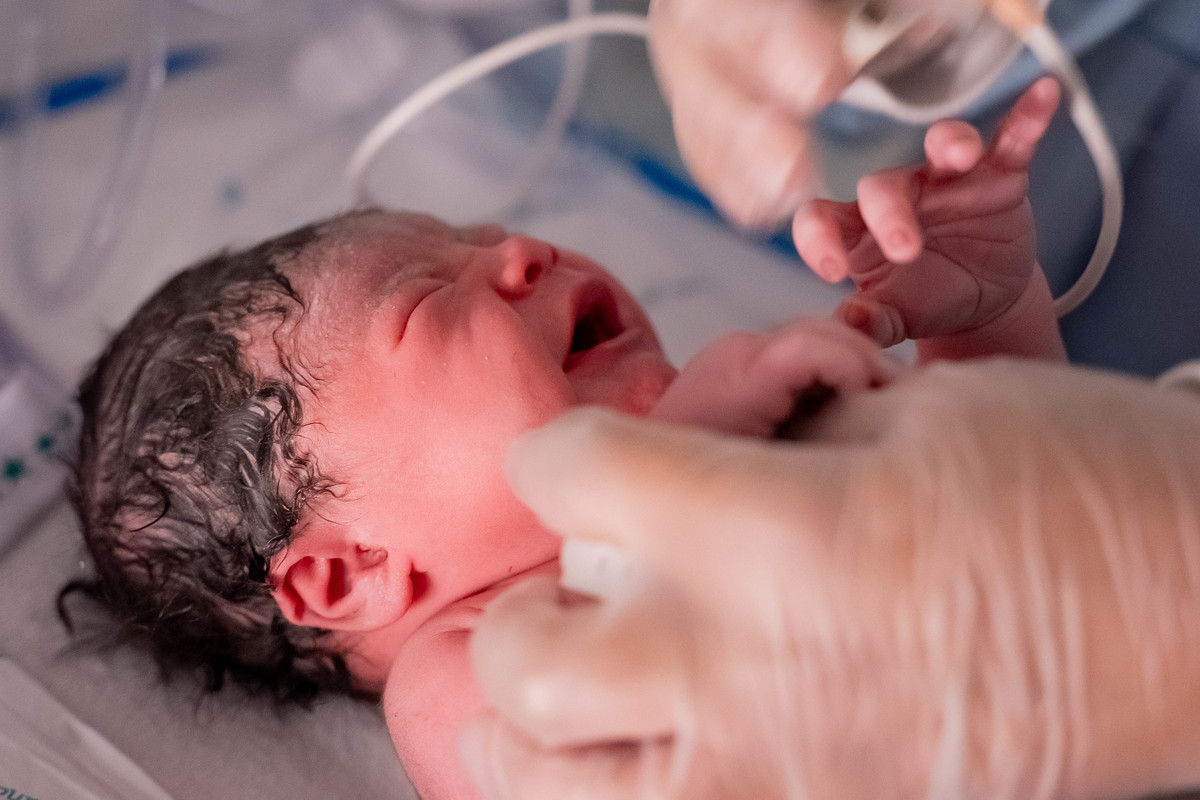 parto-fotografia-maternidade-santa-joana-estudio-thais-castro-partonormal-cesariana