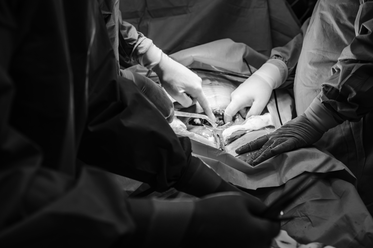 fotografia-parto-cesaria-rede-dor-recem-nascido-estudio-thais-castro-brooklin-morumbi-ibirapuera-moema-abc-tatuapé