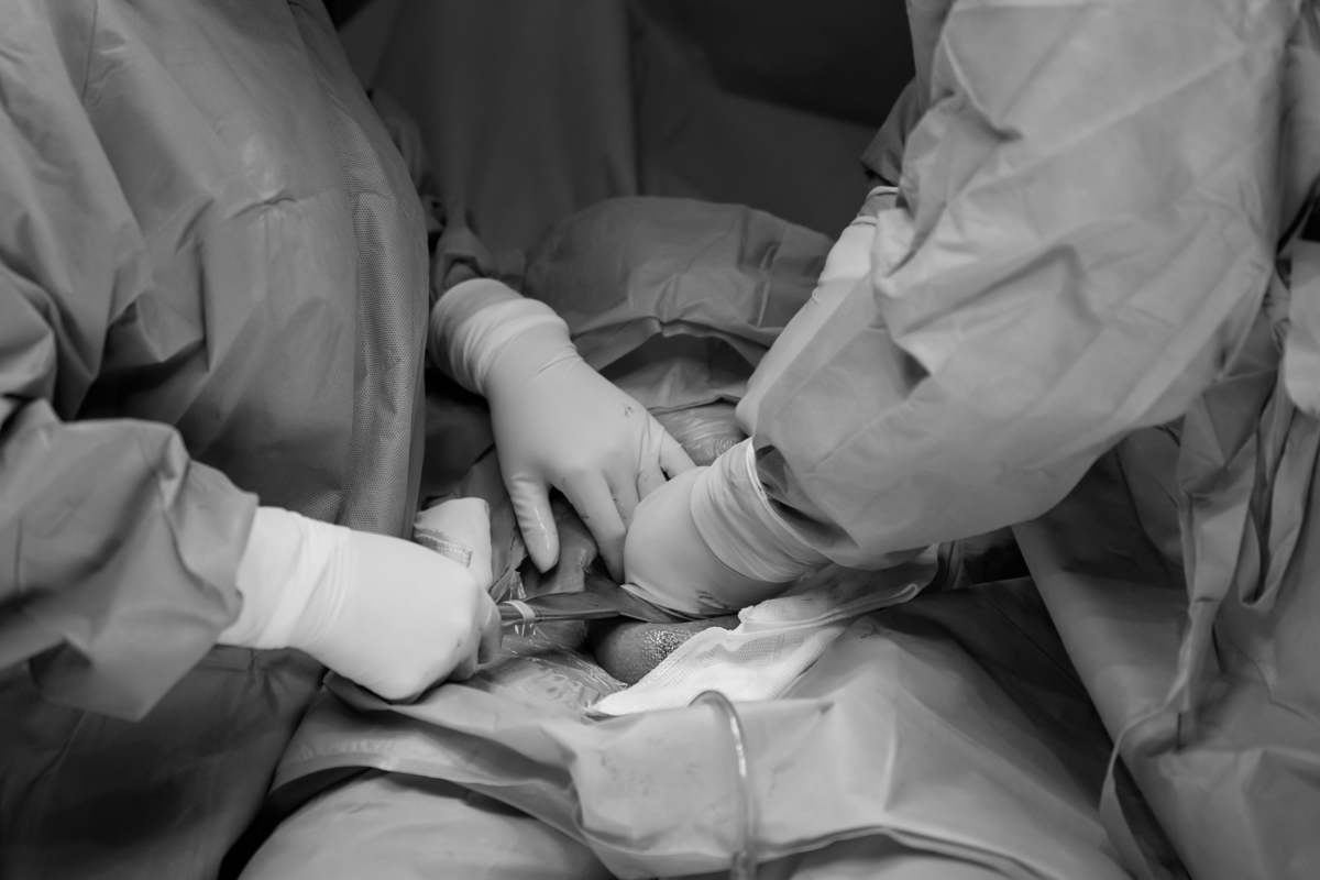 fotografia-filmagem-parto-cesaria-normal-maternidade-star-itaim-moema-são-paulo-estudio-thais-castro