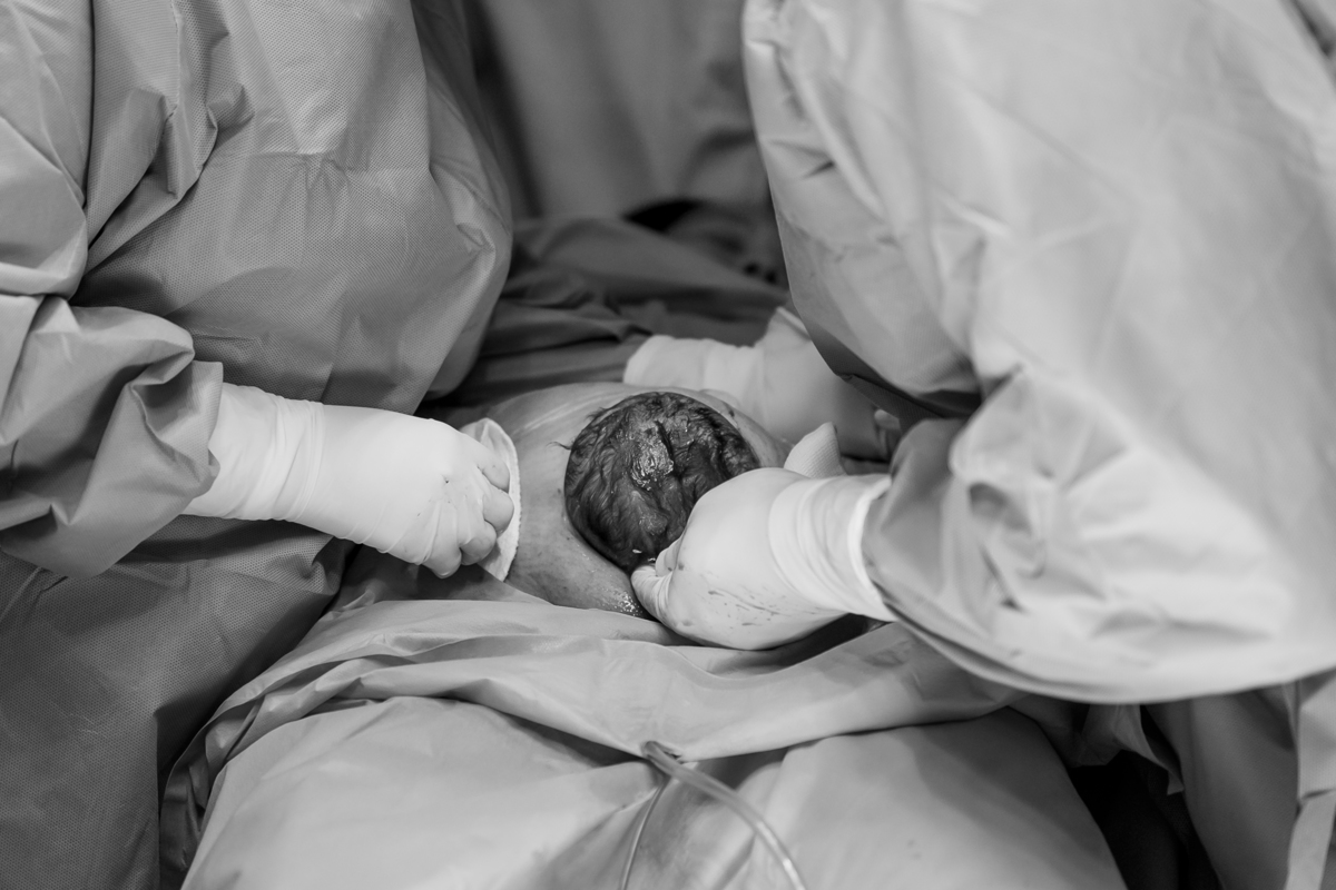 fotografia-filmagem-parto-cesaria-normal-maternidade-star-itaim-moema-são-paulo-estudio-thais-castro