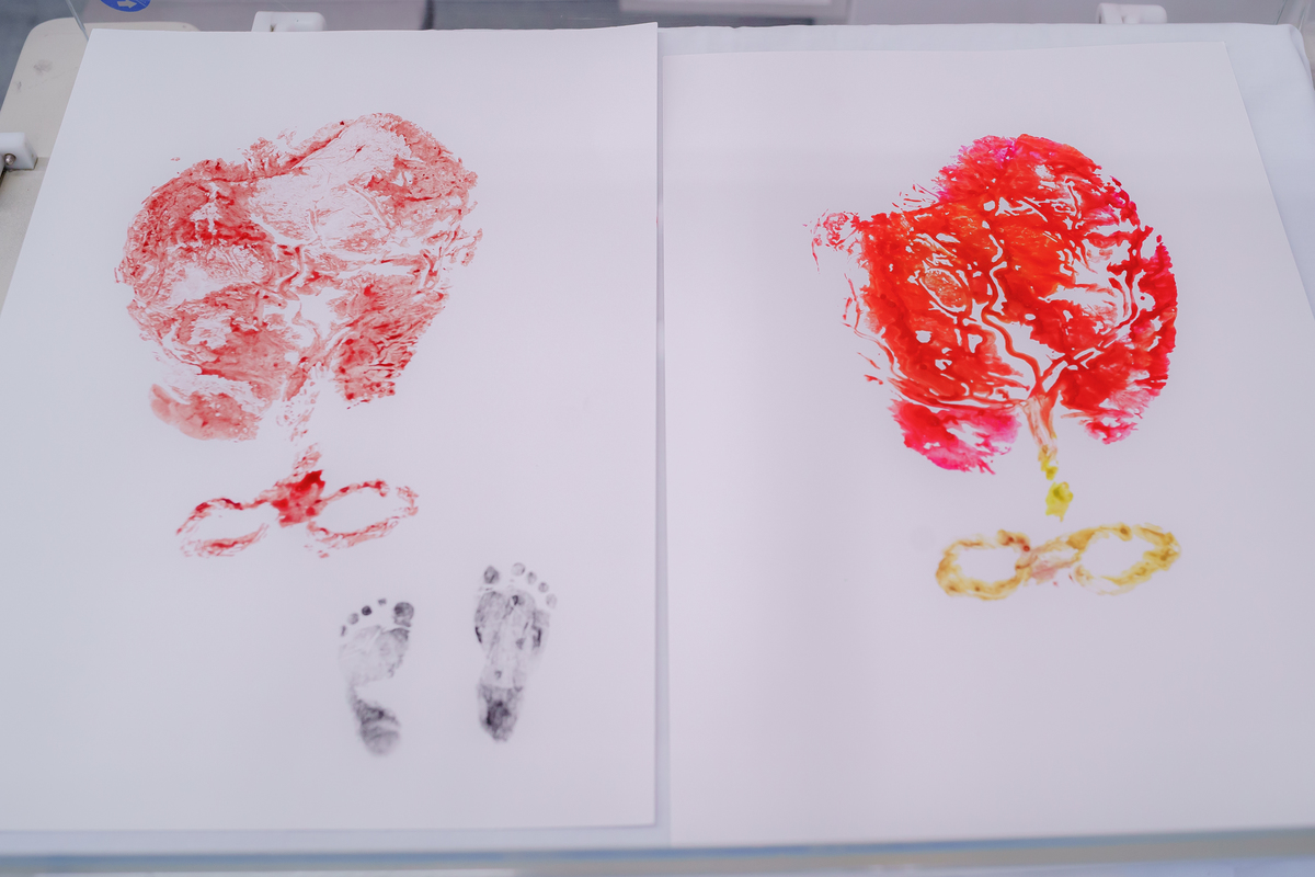 Fotografia de Parto  -Estúdio Thais Castro