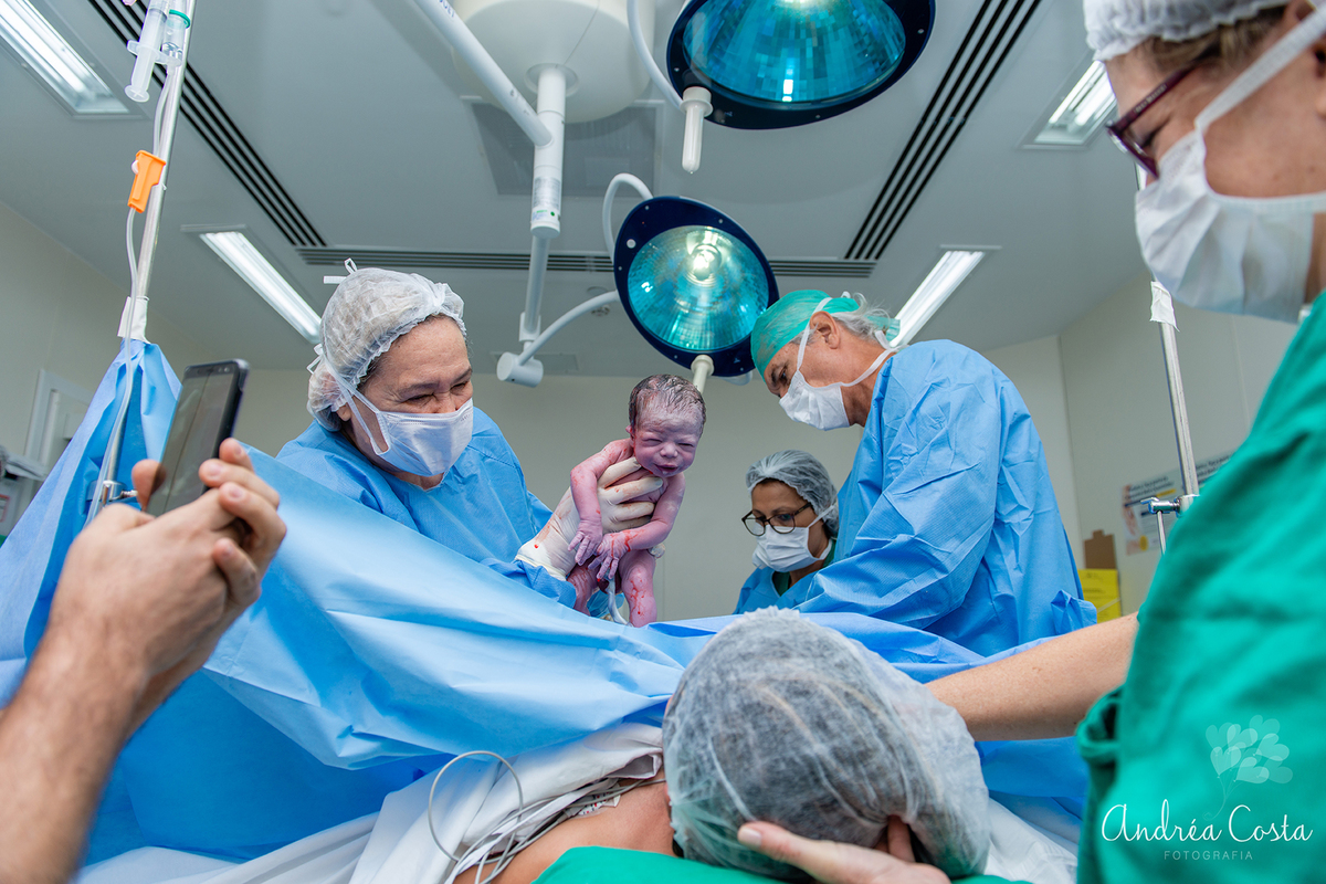 médica mostrando Benjamim para a mamãe após o seu nascimento, por Andréa Costa