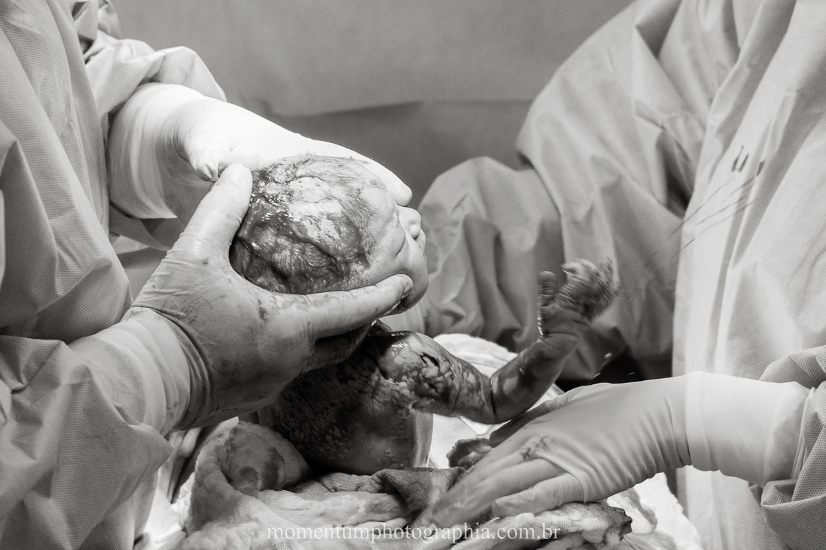 Foto tirada por Momentum Photographia na maternidade do Hospital Santa Teresa em Petrópolis - RJ que retrata o nascimento do bebê