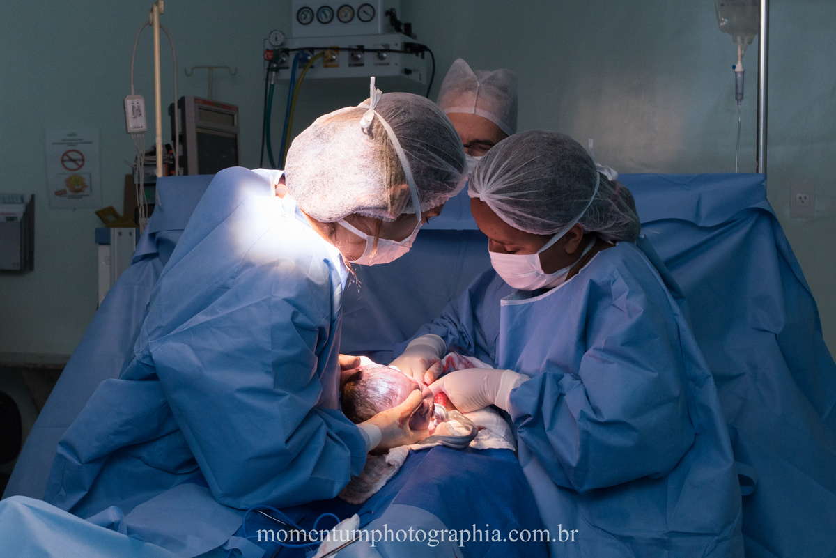 Fotografia de parto hospital Unimed Petropolis, RJ. Foto de Momentum Photographia. 