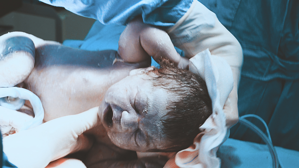 Vitória Scanegatta Vicari nasceu no 03 de Março de 2020 no Hospital de Caridade de Erechim. Fotografo de nascimento Vitor Trombetta