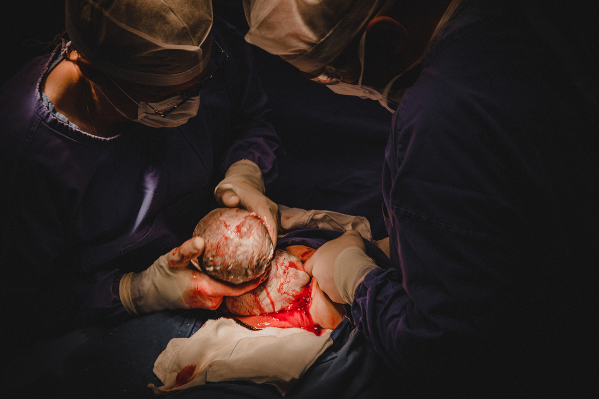 nascendo filho parto cesarea Dr. Bigolin Clinica Gineclinica Hospital de Caridade de Erechim