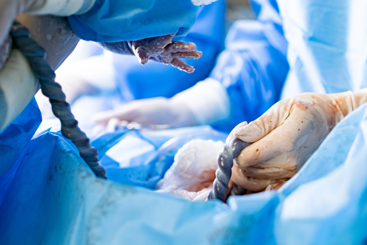 ensaio de parto em osasco do Bernardo