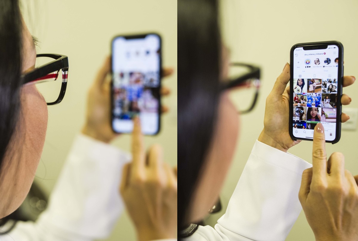 Dra Milena Chibana - Hcloe - Oftalmologia
