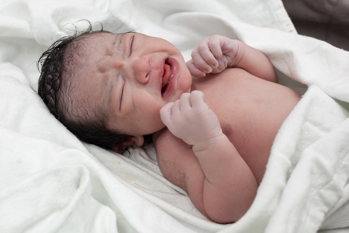 FoTOGRAFA DE PARTO CESÁREA 