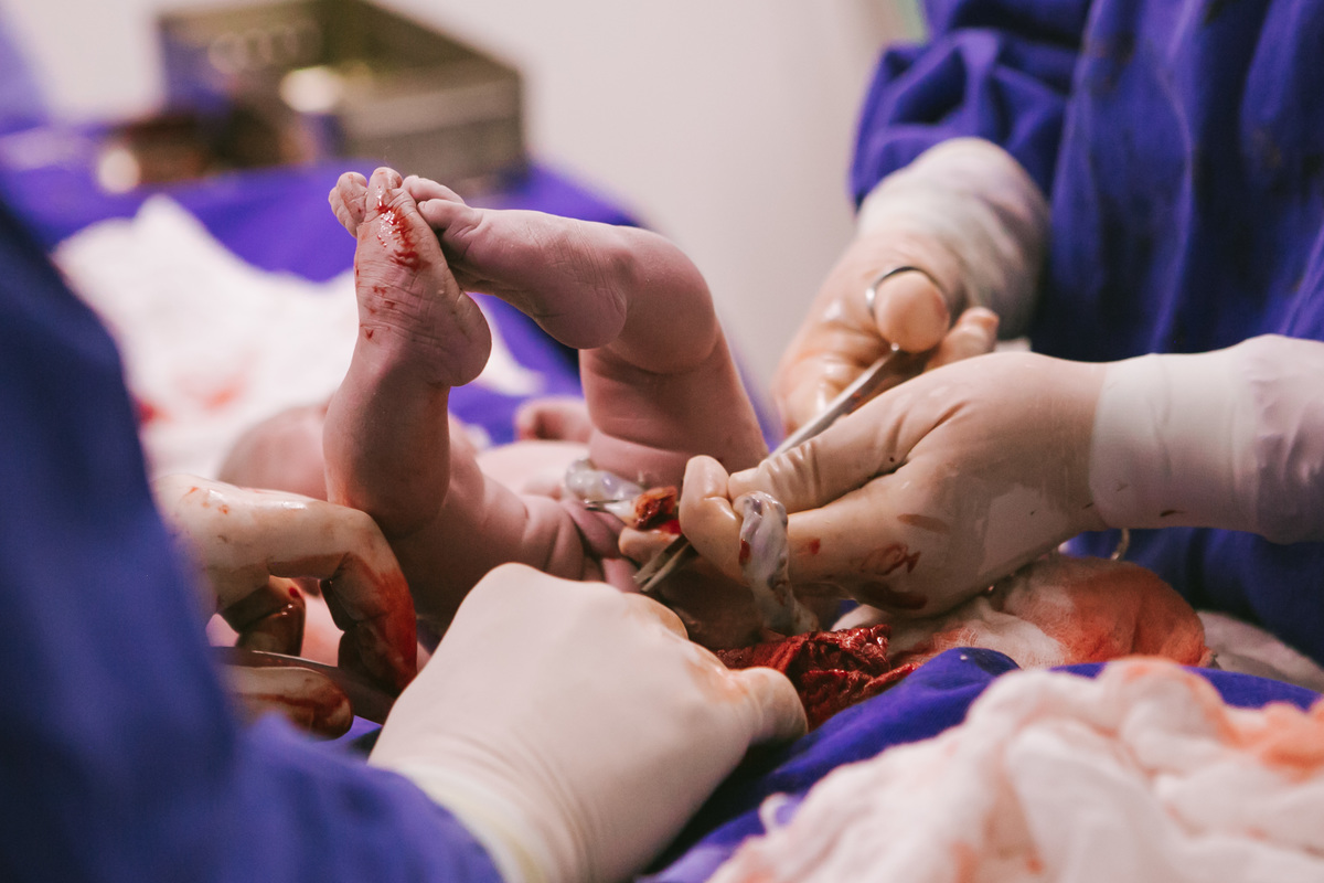 cesária, cordão umbilical, medico obstetra,