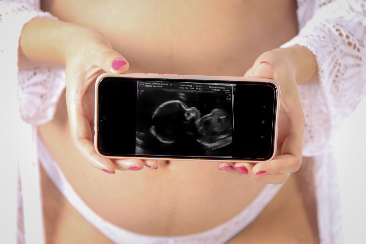 fotografia com o ultrasom