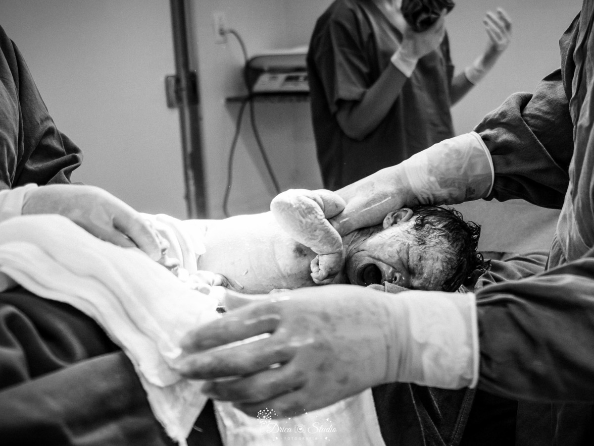 fotografia de parto - parto- gestação - nascimento - nascimento bebê - fotografa de parto - drica studio - xinguara- para - fotografa infantil - bebe nascendo - sala de parto - cesariana- parto cesariano - mãe - mãe e bebê - gestante - gestação
