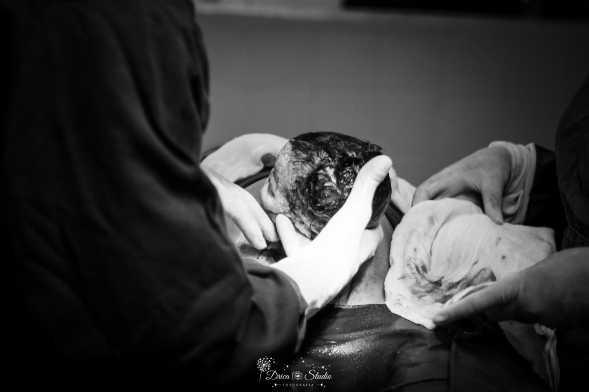 fotografia de parto - parto- gestação - nascimento - nascimento bebê - fotografa de parto - drica studio - xinguara- para - fotografa infantil - bebe nascendo - sala de parto - cesariana- parto cesariano - mãe - mãe e bebê - gestante - gestação