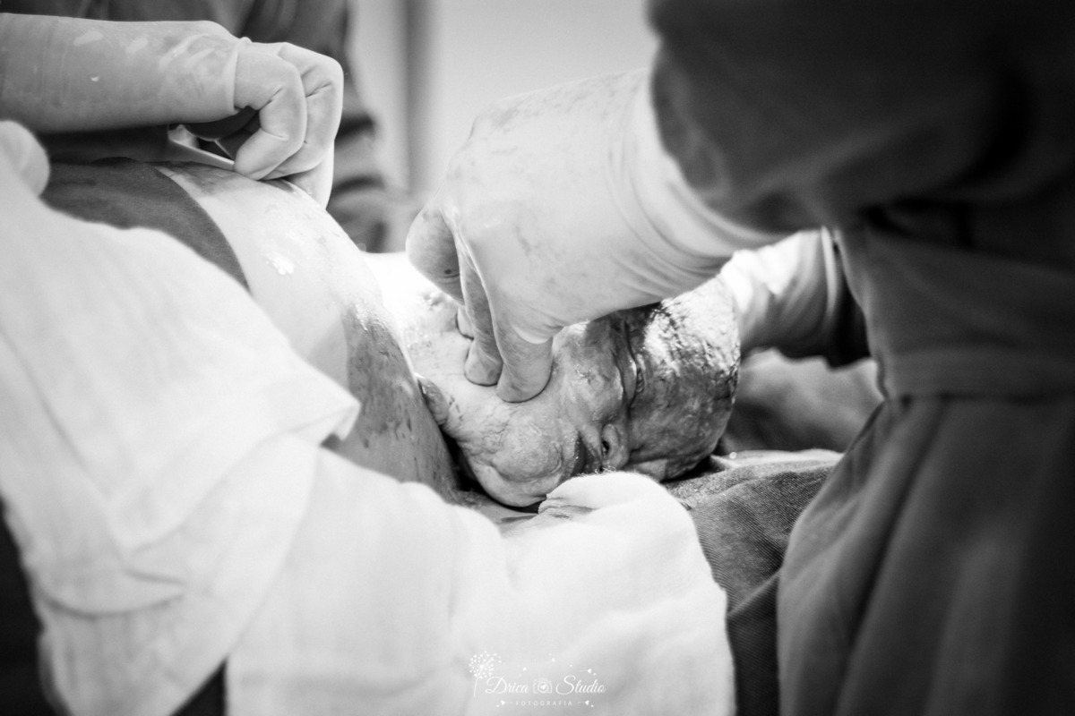 fotografia de parto - parto- gestação - nascimento - nascimento bebê - fotografa de parto - drica studio - xinguara- para - fotografa infantil - bebe nascendo - sala de parto - cesariana- parto cesariano - mãe - mãe e bebê - gestante - gestação