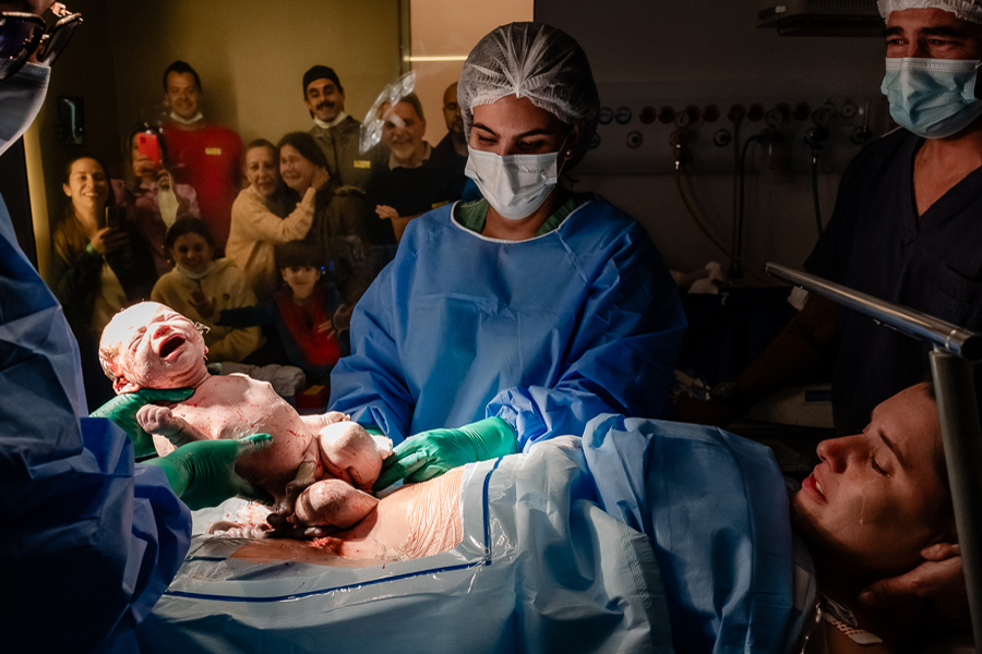 fotografia de parto do nascimento da Maya na maternidade Rede D'Or São Luiz Morumbi na cidade de Sâo Paulo