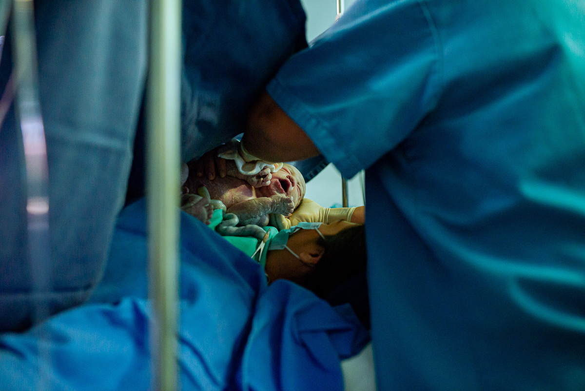 Fotografo de parto fotografia de parto parto cesaria fotografo presidente prudente pirapozinho fotografosp