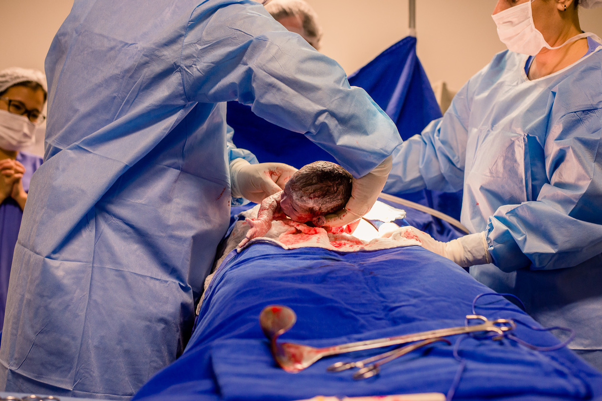 fotografo de parto fotografia de parto foto nascimento parto gestante fotos gestante ensaio gravida