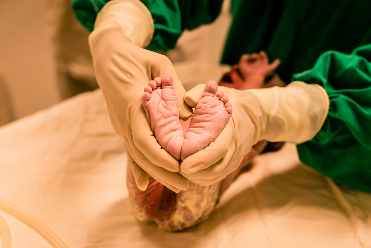 fotografo de parto fotografia de parto foto nascimento parto gestante fotos gestante ensaio gravida