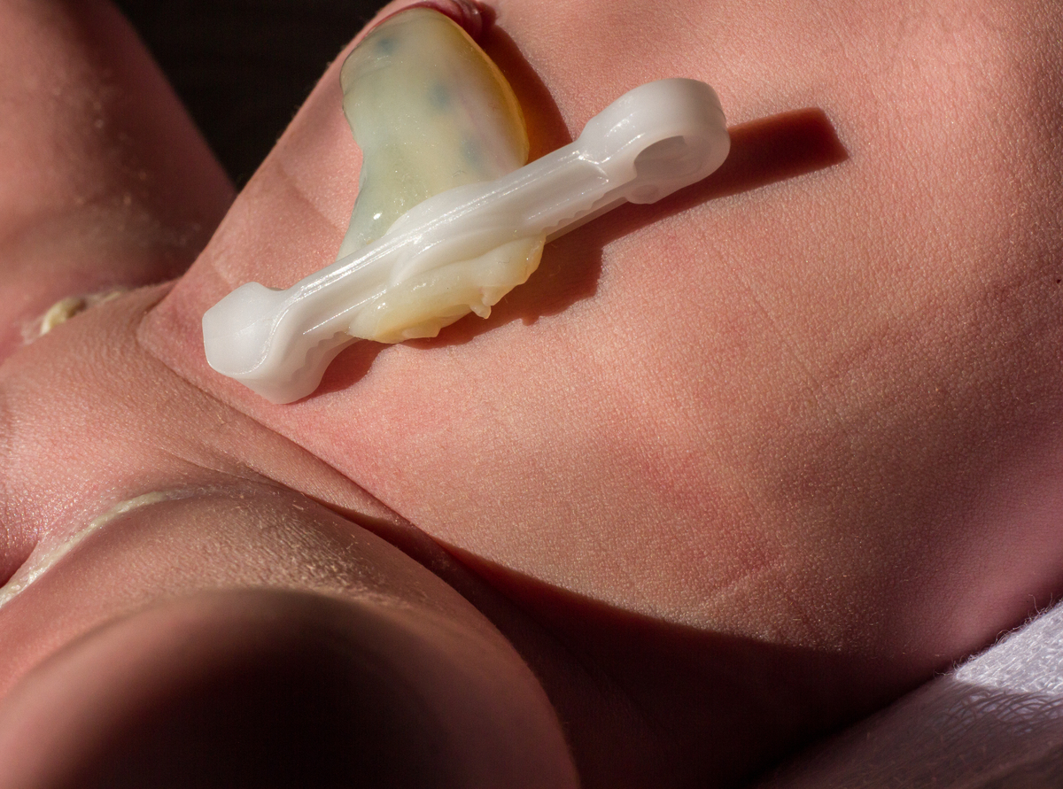 PARTO NATURAL DOMICILIAR 