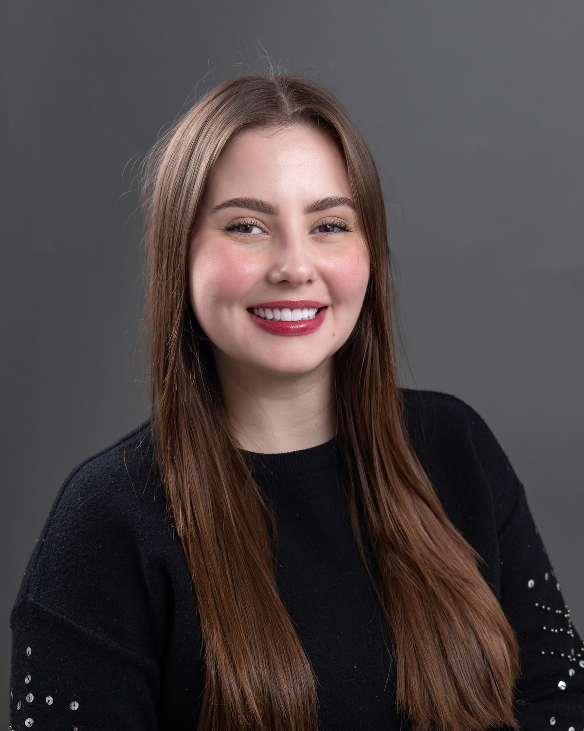 Imagem da transformação do sorriso com resina composta, sem desgastes dos dentes naturais. 