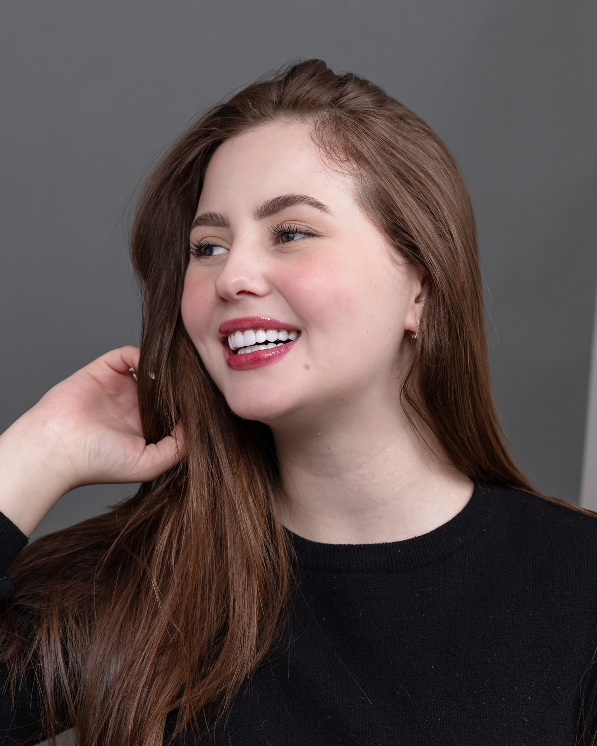 Imagem da transformação do sorriso com resina composta, sem desgastes dos dentes naturais. 