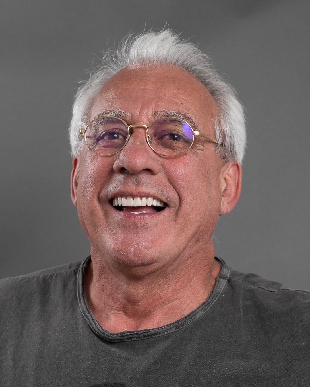 Imagem da transformação do sorriso com resina composta. Dentes perfeitos e com cor natural.