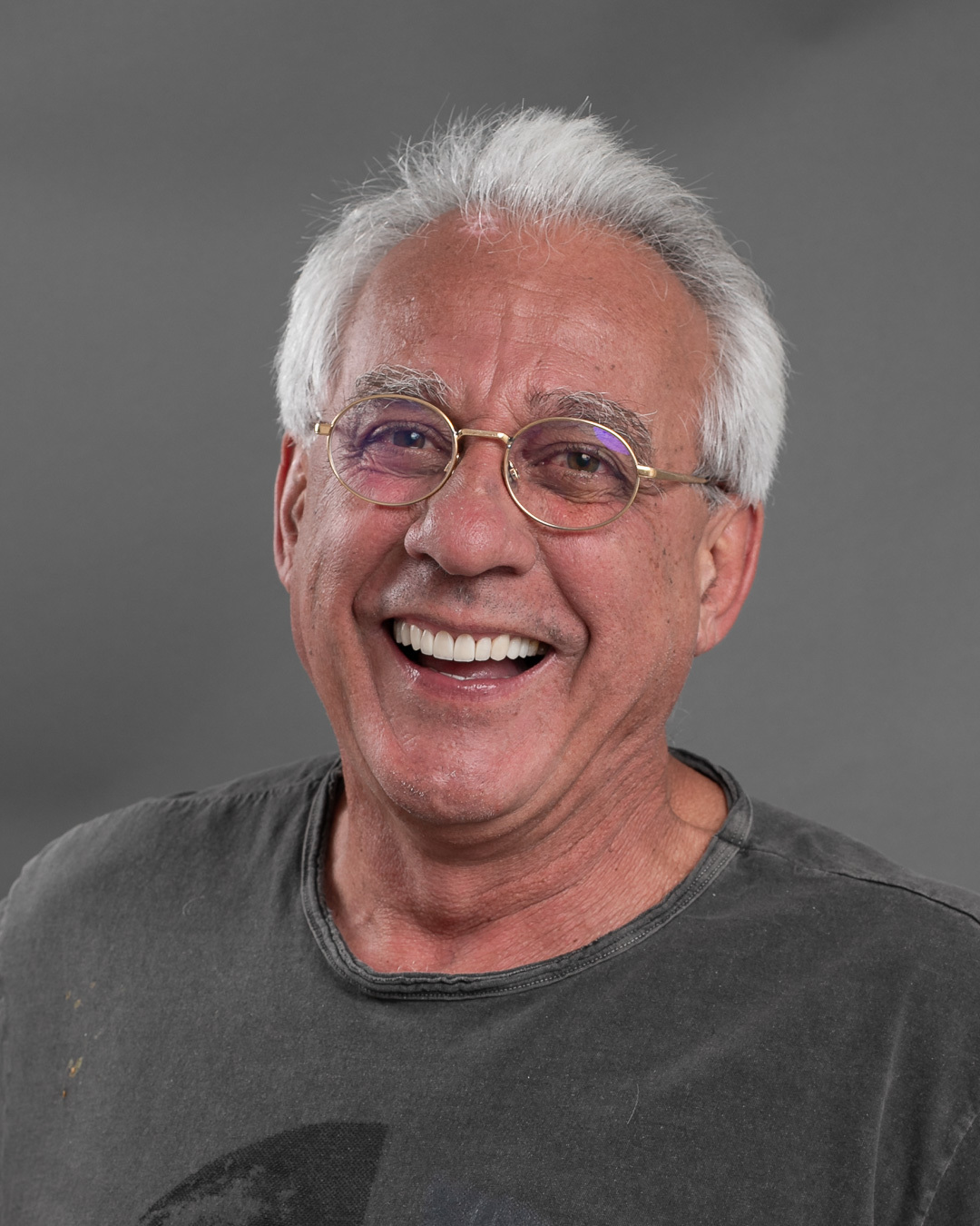 Imagem da transformação do sorriso com resina composta. Dentes perfeitos e com cor natural.