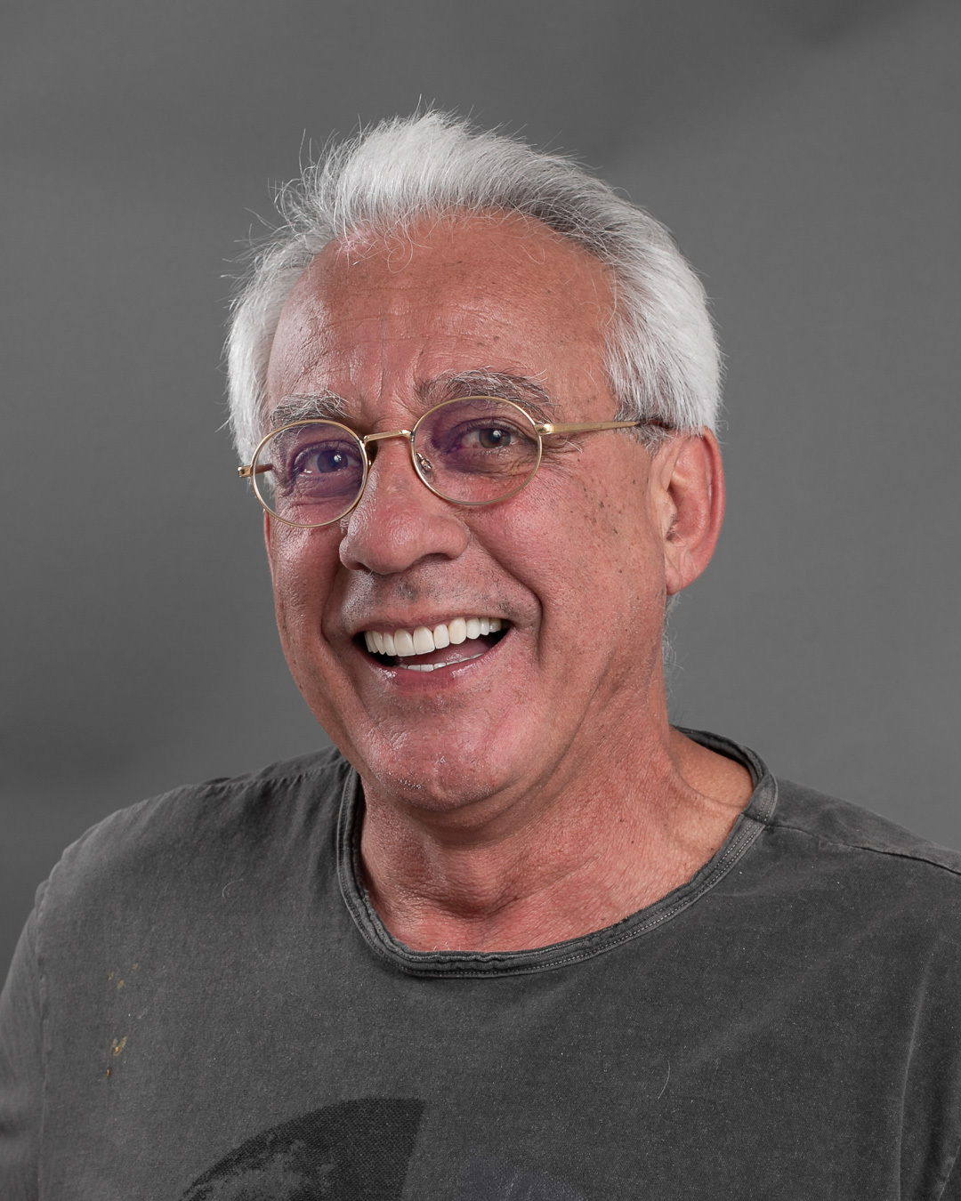 Imagem da transformação do sorriso com resina composta. Dentes perfeitos e com cor natural.