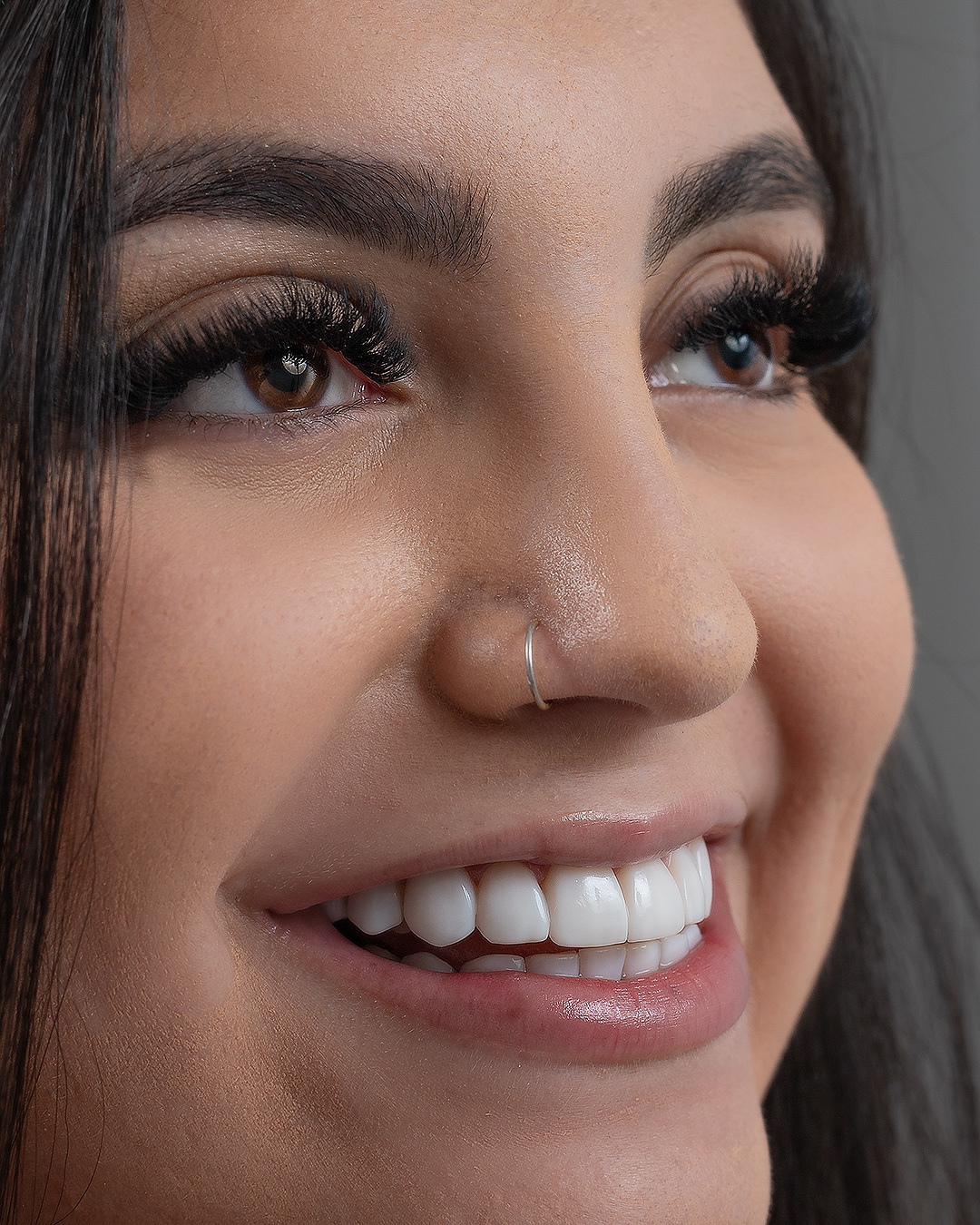 respeitando a anatomia dos dentes. Alla Vita Odontologia transforma e cuida do seu sorriso.