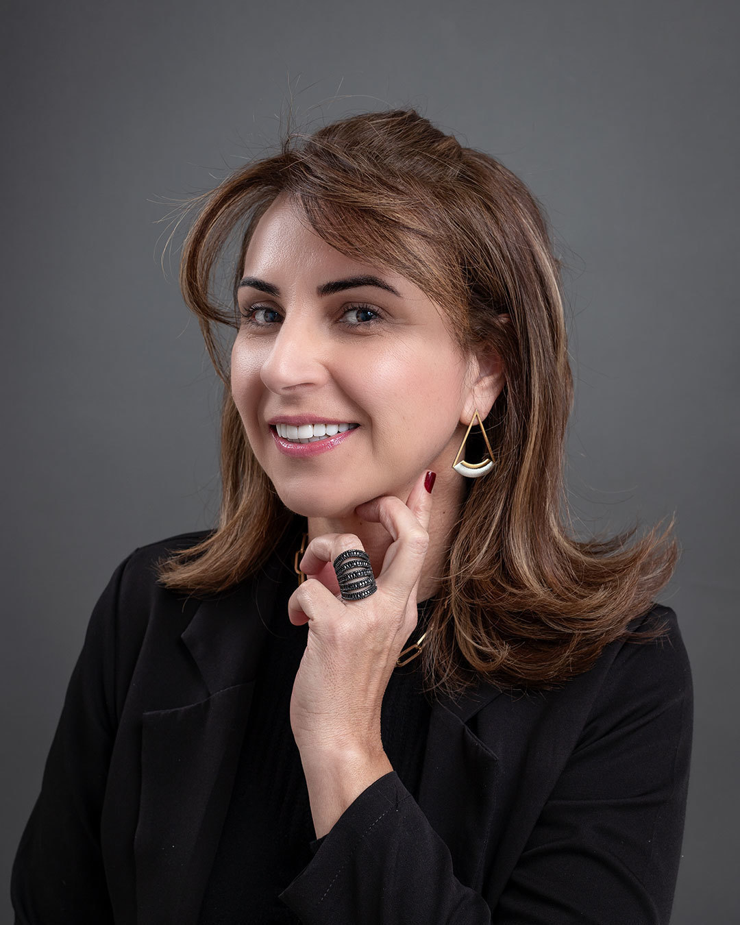 Imagem da transformação do sorriso com resina composta, sem desgastes dos dentes naturais. 