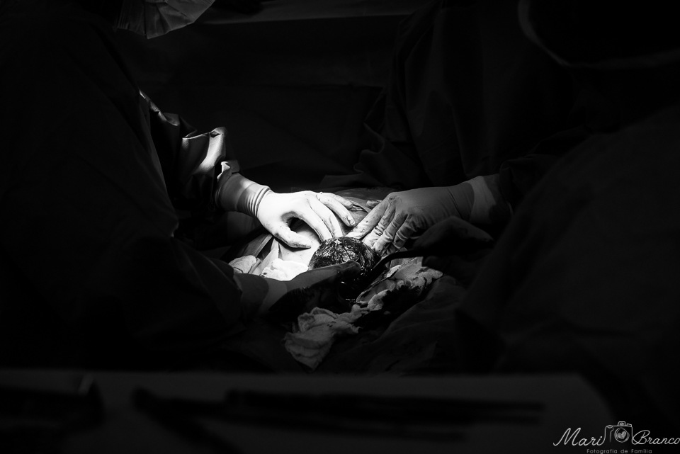 Fotografia de parto normal cesárea na maternidade hospital Paster e Perinatal